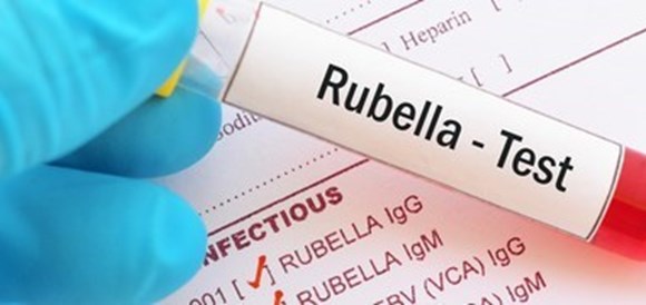 בדיקת נוגדנים לאדמת - Rubella Antibodies- IgG - תמונה